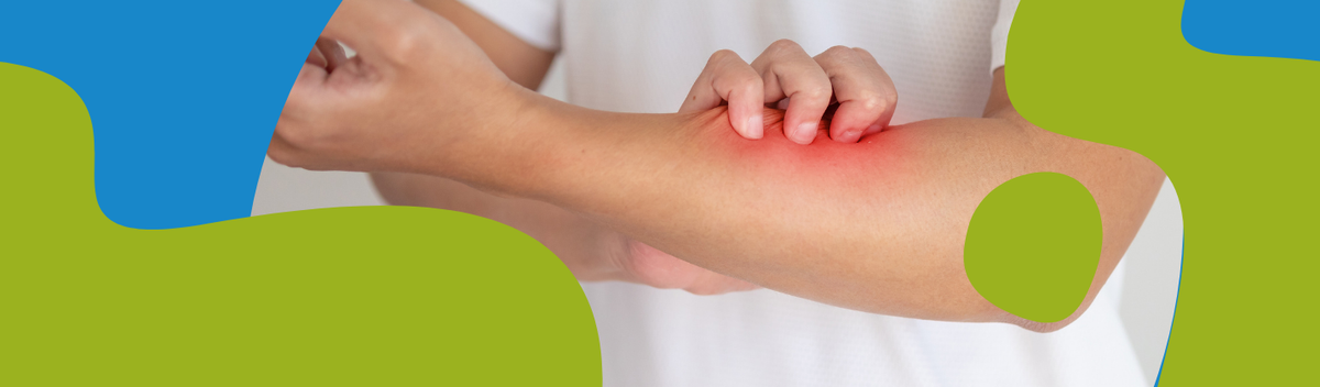 Psoriasis: Symptoms, Treatment and Daily Management