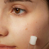 COSRX The AHA 2 BHA 2 Blemish Treatment Serum - 50 g